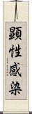 顕性感染 Scroll