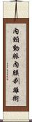 内頸動脈内膜剥離術 Scroll