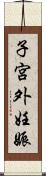 子宮外妊娠 Scroll