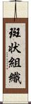 斑状組織 Scroll