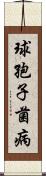 球孢子菌病 Scroll