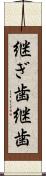 継ぎ歯 Scroll