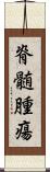 脊髄腫瘍 Scroll