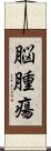 脳腫瘍 Scroll