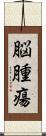 脳腫瘍 Scroll