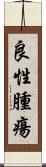 良性腫瘍 Scroll