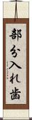 部分入れ歯 Scroll