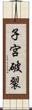 子宮破裂 Scroll