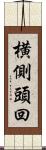 横側頭回 Scroll