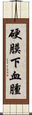 硬膜下血腫 Scroll