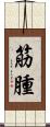 筋腫 Scroll