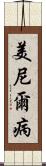 美尼爾病 Scroll