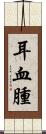 耳血腫 Scroll