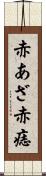 赤あざ Scroll