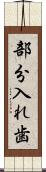 部分入れ歯 Scroll