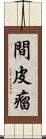 間皮瘤 Scroll