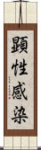 顕性感染 Scroll