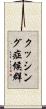 クッシング症候群 Scroll