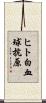 ヒト白血球抗原 Scroll