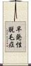 早発性脱毛症 Scroll