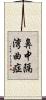 鼻中隔湾曲症 Scroll