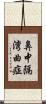 鼻中隔湾曲症 Scroll