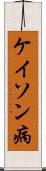 ケイソン病 Scroll