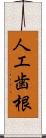 人工歯根 Scroll