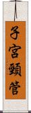 子宮頸管 Scroll