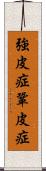 強皮症 Scroll