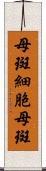 母斑細胞母斑 Scroll