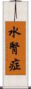 水腎症 Scroll