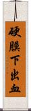 硬膜下出血 Scroll