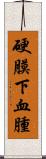 硬膜下血腫 Scroll