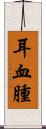 耳血腫 Scroll