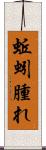 蚯蚓腫れ Scroll