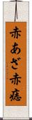 赤あざ Scroll