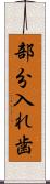 部分入れ歯 Scroll