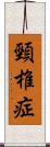 頸椎症 Scroll