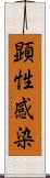 顕性感染 Scroll