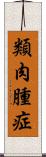 類肉腫症 Scroll