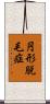 円形脱毛症 Scroll