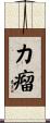 力瘤 Scroll
