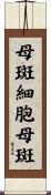 母斑細胞母斑 Scroll
