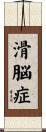 滑脳症 Scroll