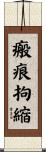 瘢痕拘縮 Scroll