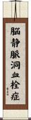脳静脈洞血栓症 Scroll