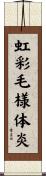 虹彩毛様体炎 Scroll