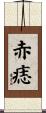 赤痣 Scroll