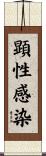 顕性感染 Scroll
